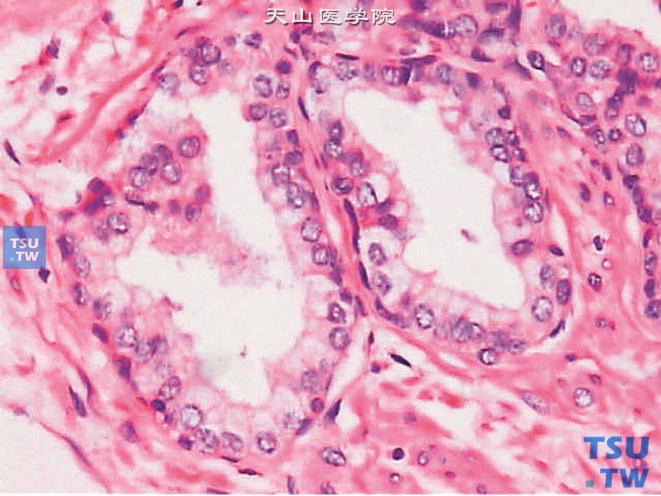 前列腺上皮分泌细胞呈柱状，胞质着色浅，境界清晰