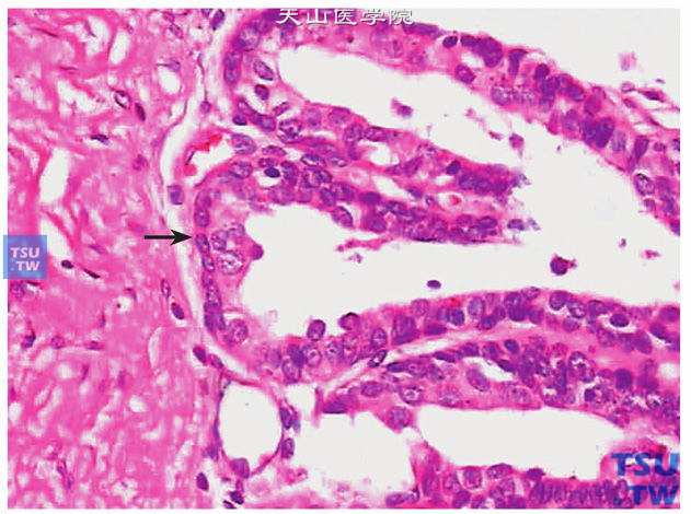 箭头示前列腺上皮基底细胞，位于分泌细胞和基底膜之间，核卵圆形