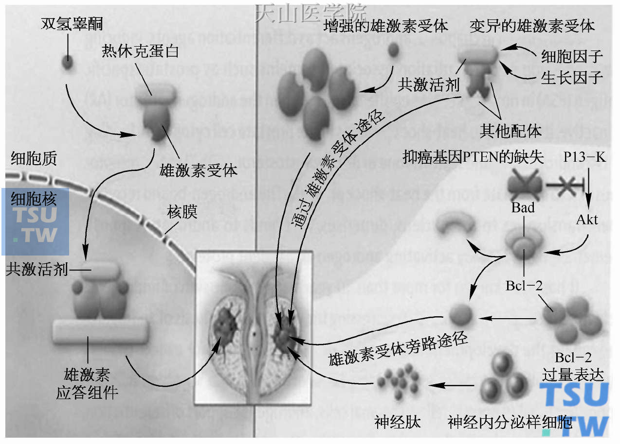 雄激素受体在前列腺癌中的作用