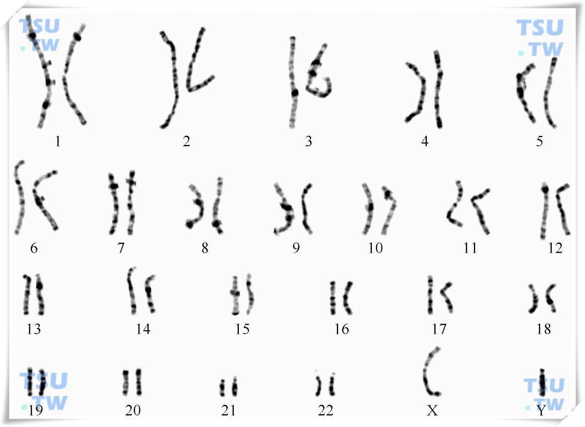 人类染色体和染色体异常