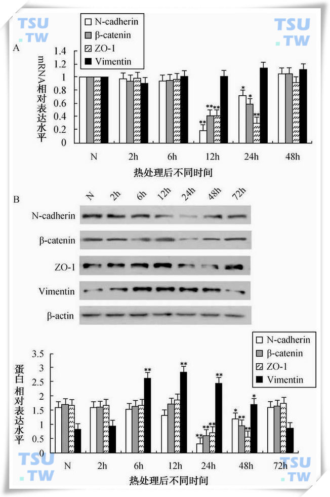  43℃热处理支持细胞后不同时间点N-cadherin，β-catenin，ZO-1和vimentin的mRNA及蛋白表达水平分析