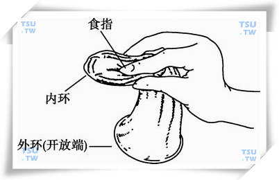 屏障避孕法：男用、女用避孕套、阴道隔膜、宫颈帽等