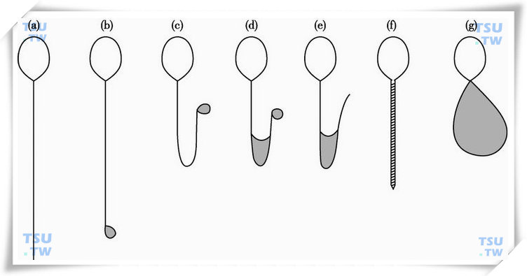  人精子在低渗透压作用下的特征性形态变化的示意图