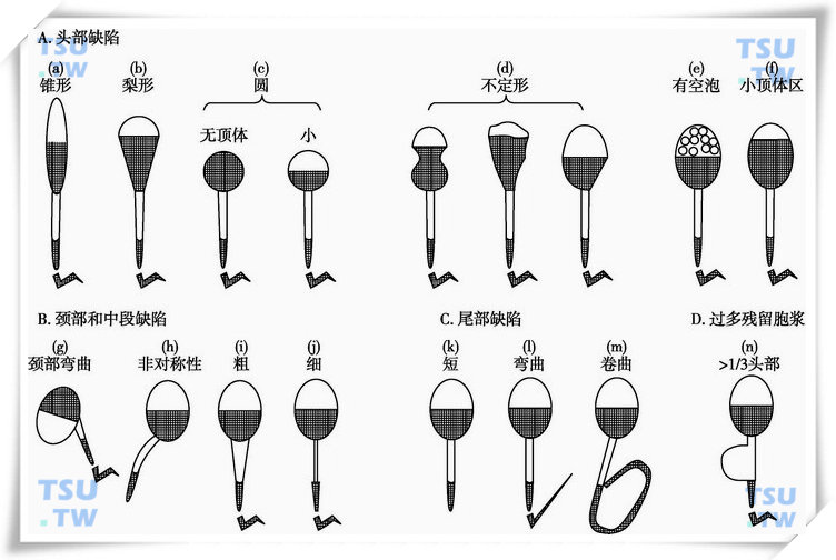  人精子一些异常形态的示意图