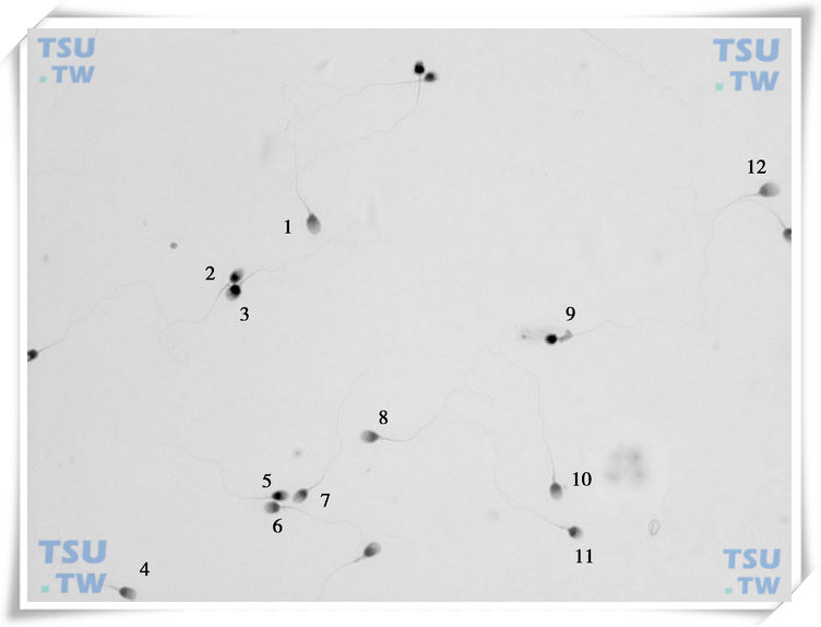  精子巴氏染色形态学图1