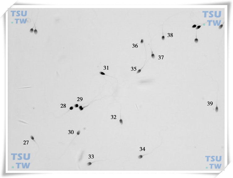  精子巴氏染色形态学图3