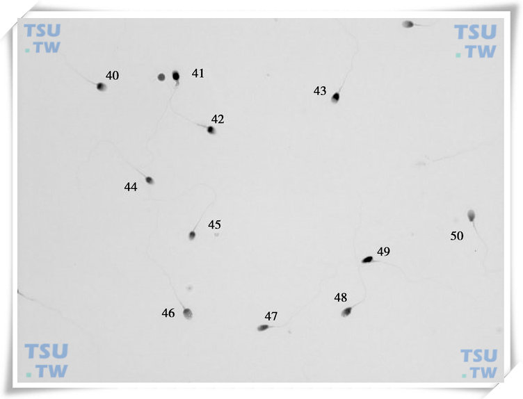  精子巴氏染色形态学图4