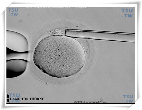  极体活检（由美国加州大学旧金山分校IVF实验室提供）