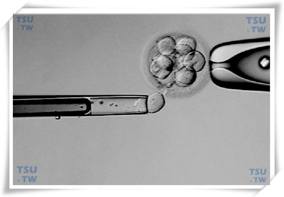  卵裂球活检（由美国加州大学旧金山分校IVF实验室提供）