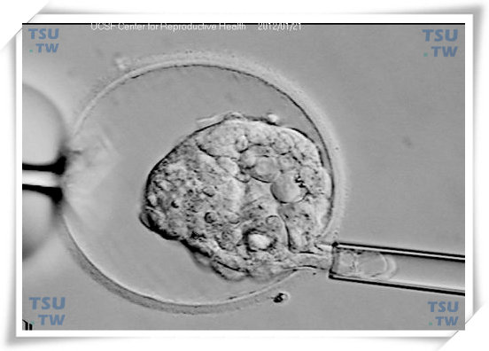  囊胚活检（由美国加州大学旧金山分校IVF实验室提供）