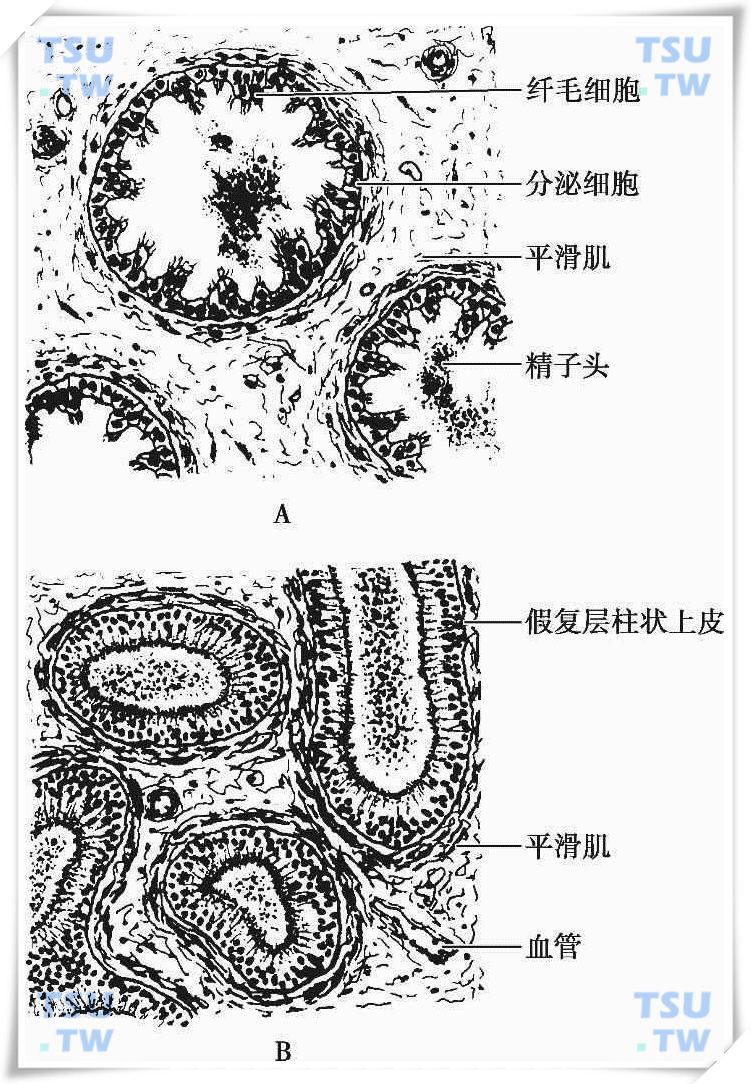 输精管道：附睾、输精管、射精管、精索、男性尿道结构解剖