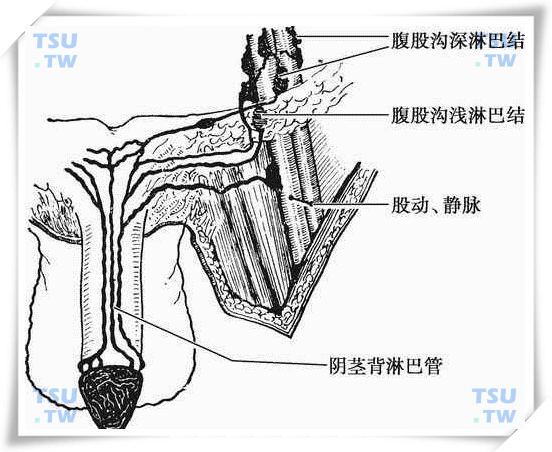  阴茎的淋巴导流模式图