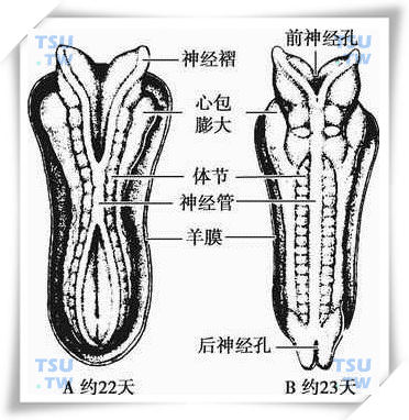 前、后神经管孔形成