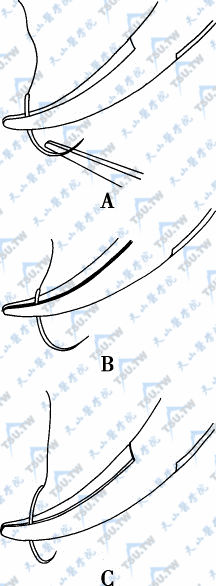 学习怎样控制针；怎样用持针器和镊子把针放在合适的位置。用镊子的尖端调整持针器中针的位置（A）。如果持针位置太靠近缝线端（B）或针尖（C），缝针就会不稳