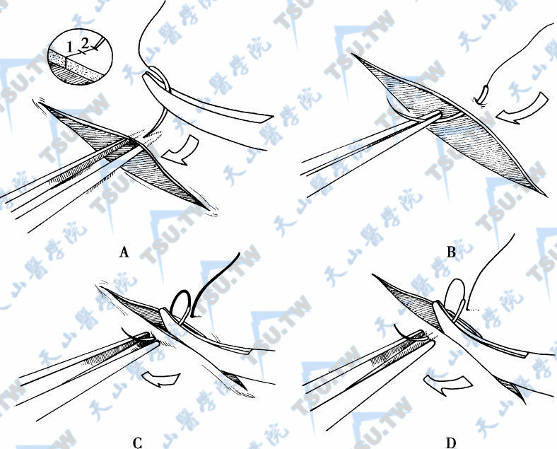进针点应该垂直在距边缘约有组织壁两倍厚的地方，镊子的两个尖端可以通过提供对抗压力帮助针穿过组织（A）。应根据针的弯曲形状把针慢慢地拉出组织边缘（B）。通过手指轻微的运动，针就会根据自身的形状特点轻轻地穿过组织边缘（C，D）