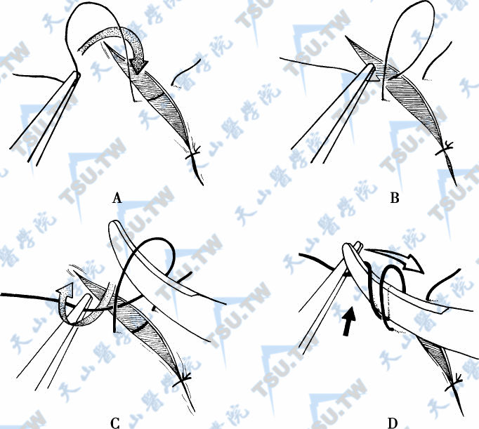 留足够长缝线末端对于在显微镜下打双环扣十分重要。用镊子尖夹住缝线向缝合处（A）顺时针环绕半圈就形成一个单环（B）。当单环形成后，用持针器尖端顺时针环绕镊子的尖端（C）以形成第二个环（D）