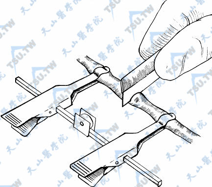 在Microspike吻合器或血管夹钳两臂之间用锋利的剃刀切断硅酮管