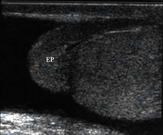 正常阴囊声像图