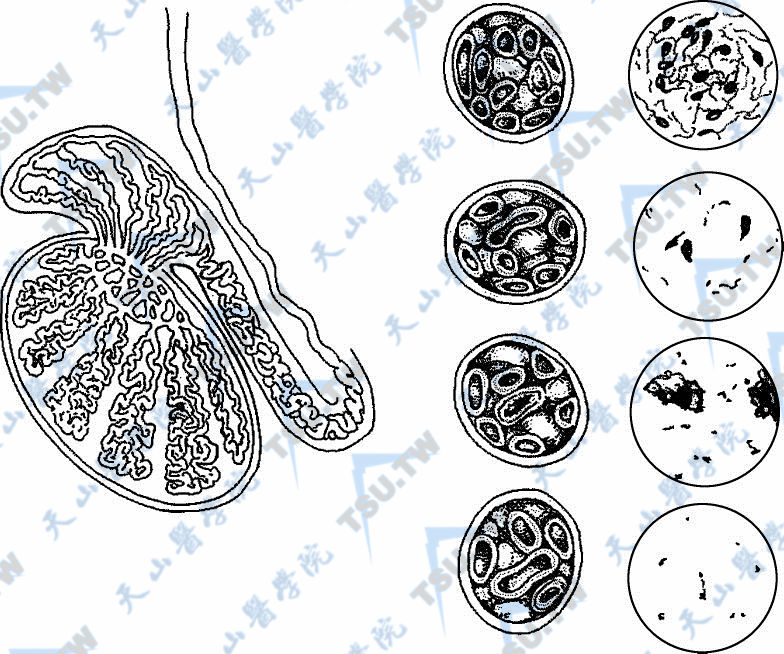 切断附睾寻找精子