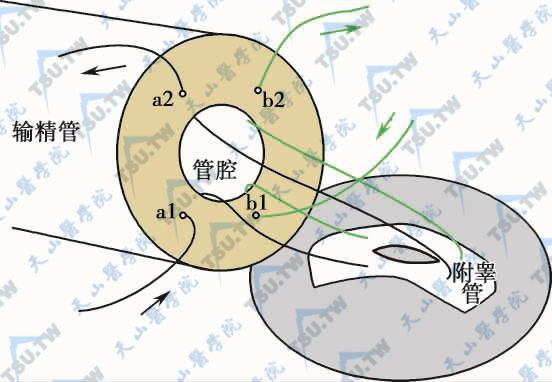 显微输精管附睾端侧吻合术（改良单针纵形套入法）