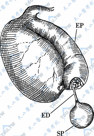 精液囊肿（SP），输出小管（ED），附睾（EP）