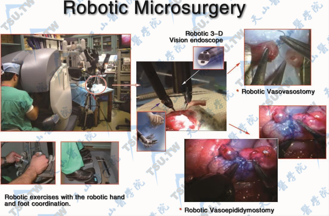 机器人显微输精管或输精管附睾吻合术