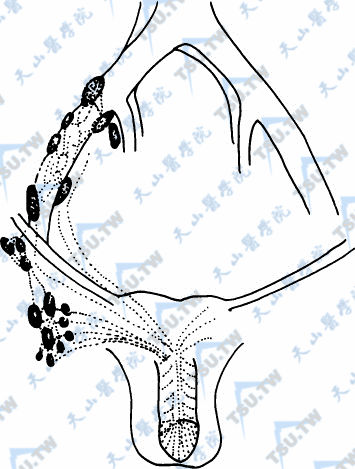 阴茎的淋巴管系