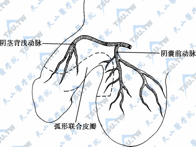 弧形带蒂阴茎阴囊联合皮瓣 