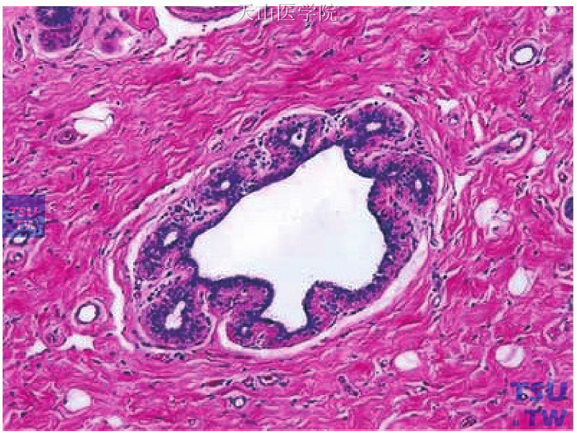 正常青春期女性乳腺导管（可见始基小叶从母导管中出芽）