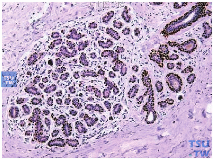正常成熟女性乳腺小叶（P63免疫染色）
