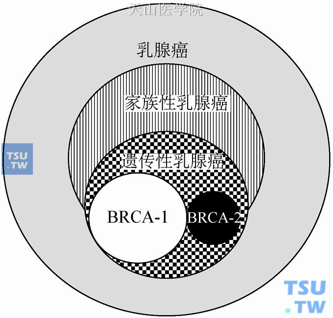 乳腺癌的分类及其关系