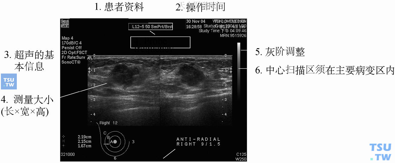 乳房超声输出影像要素