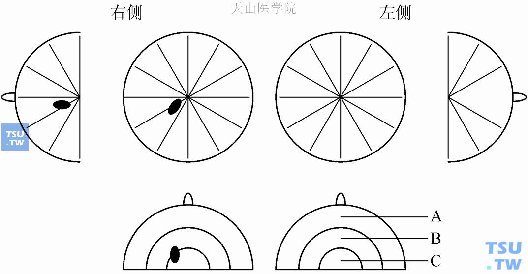 乳房超声检查病灶记录图标