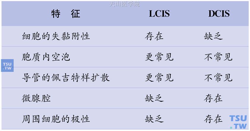 LCIS与DCIS的鉴别诊断要点