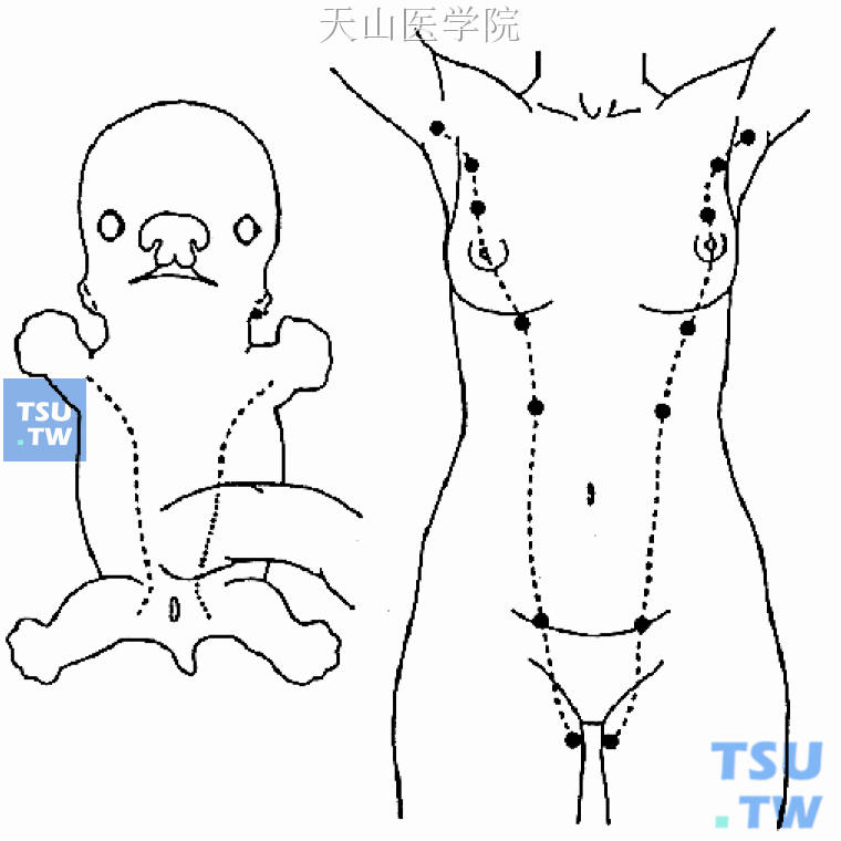 胎儿期乳线（左）及乳腺原基（右）示意图