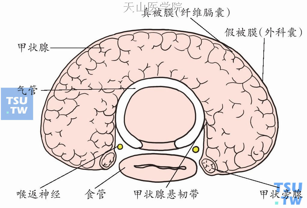 甲状腺被膜模式图
