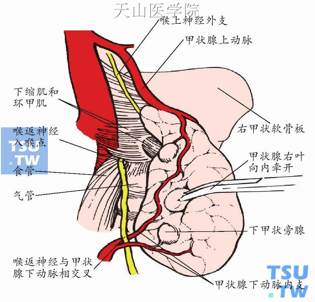 甲状腺下动脉与喉返神经走行间关系