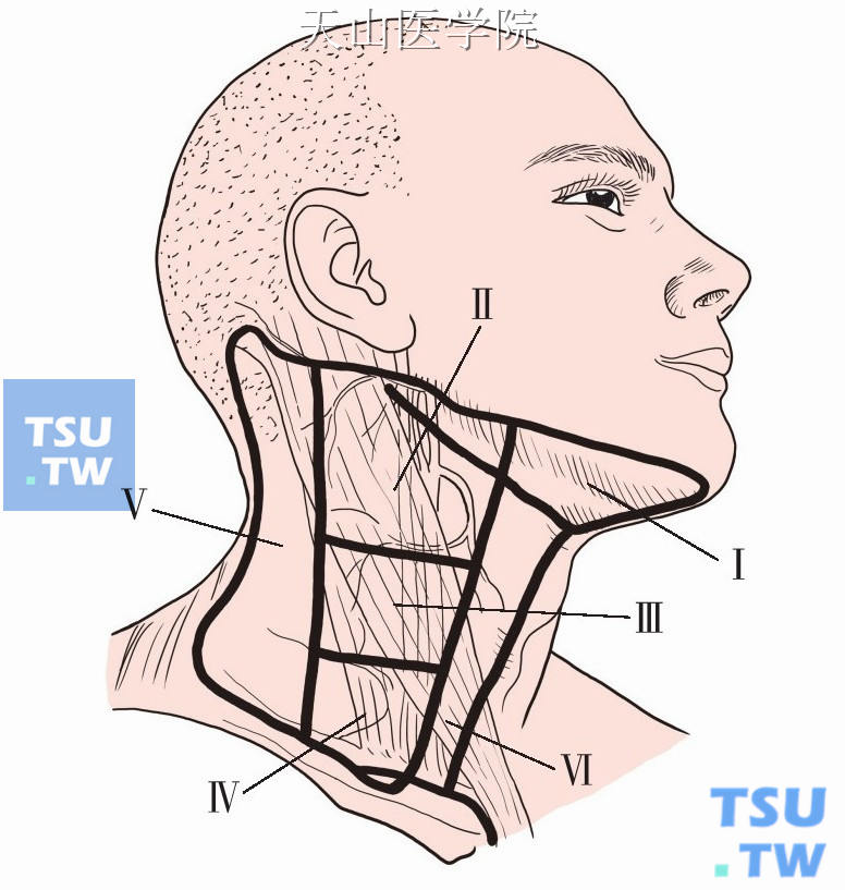 颈部淋巴结分区