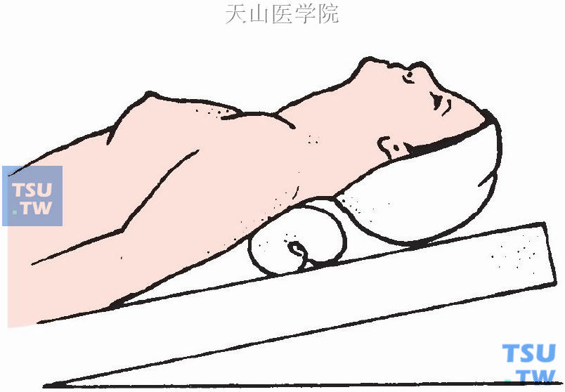 取仰卧位，床头抬高15°，肩部垫以软枕，使头部自然后仰，充分显露手术野