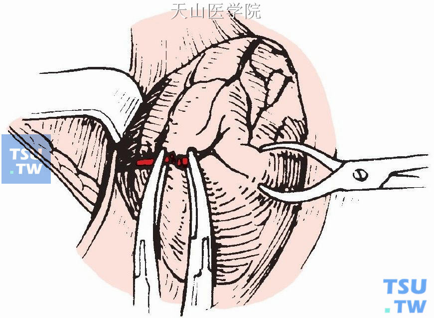 紧靠腺体切断外侧缘的血管