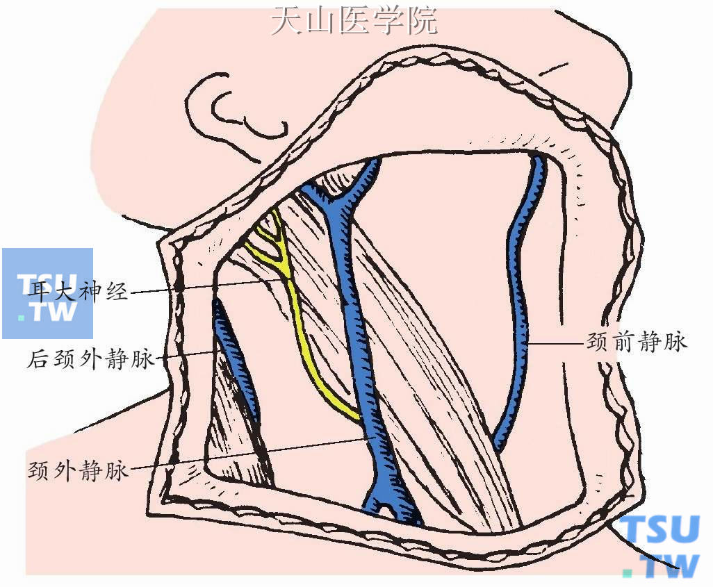 颈淋巴清扫术的命名和分类-肿瘤学-医学