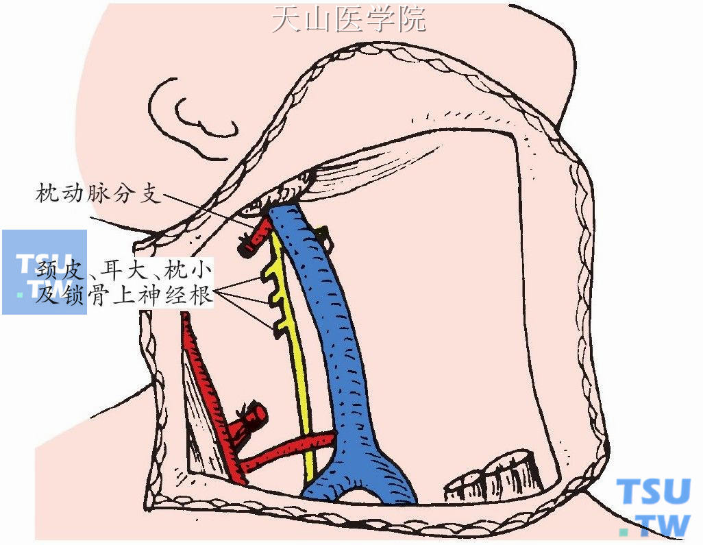 显露颈内静脉