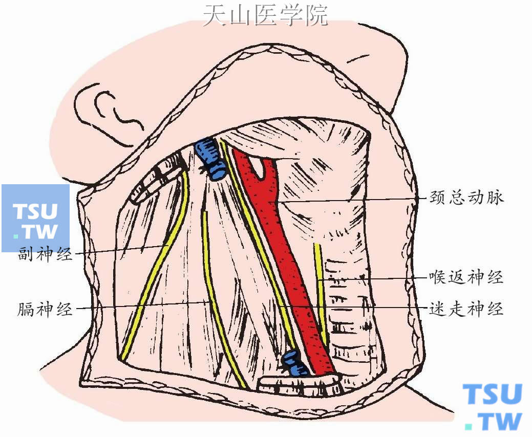 二、颈淋巴结分区-肿瘤外科手术-医学