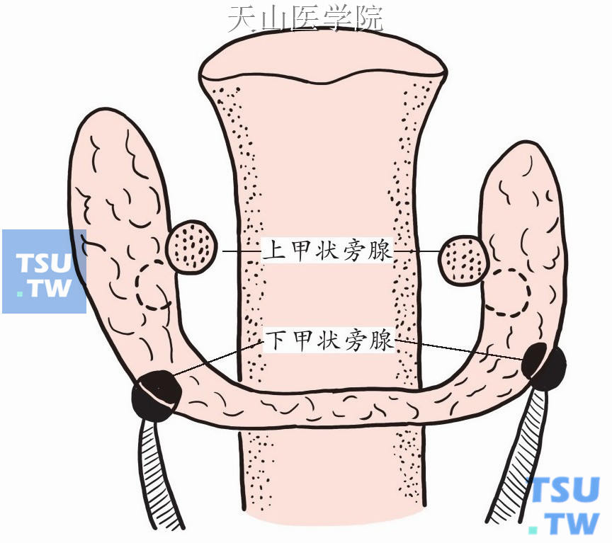 若移位不全，则下甲状旁腺可停留在上述过程的任何位置上，因此下甲状旁腺的位置变化多，但往往与胸腺有一定关系