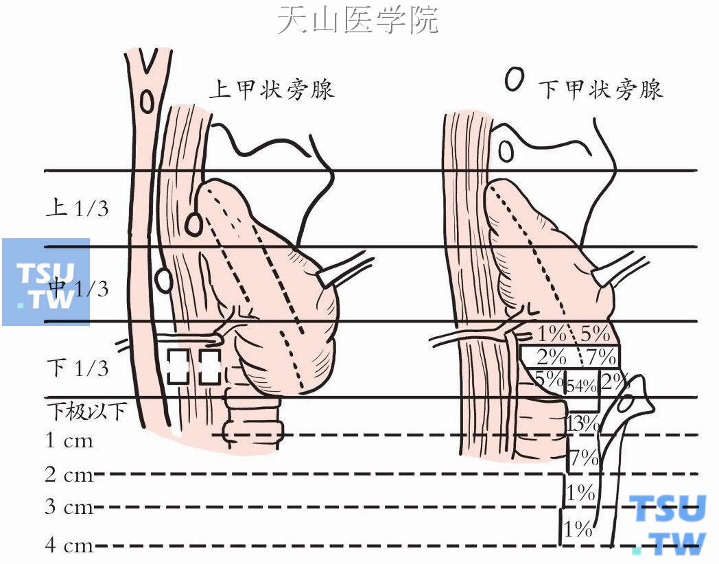 上、下甲状旁腺的部位（侧面观）