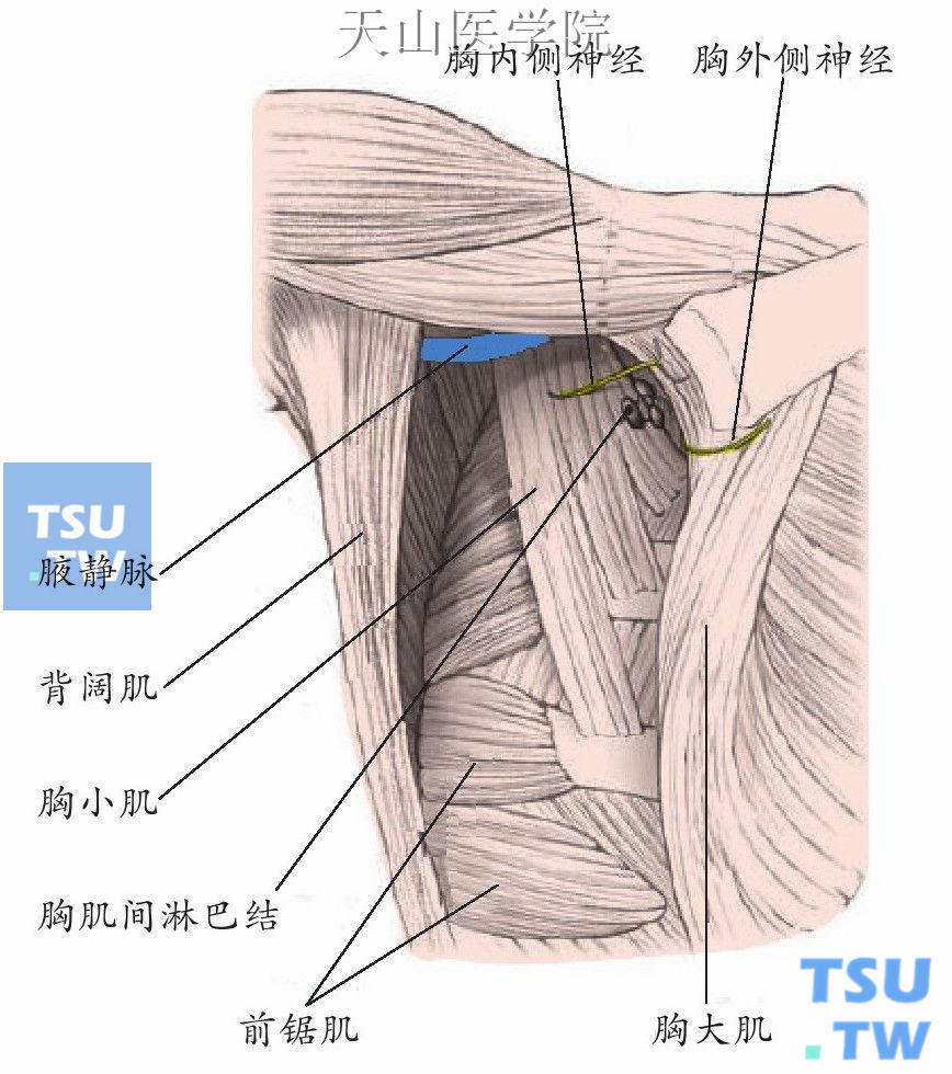 腋窝外侧壁图片