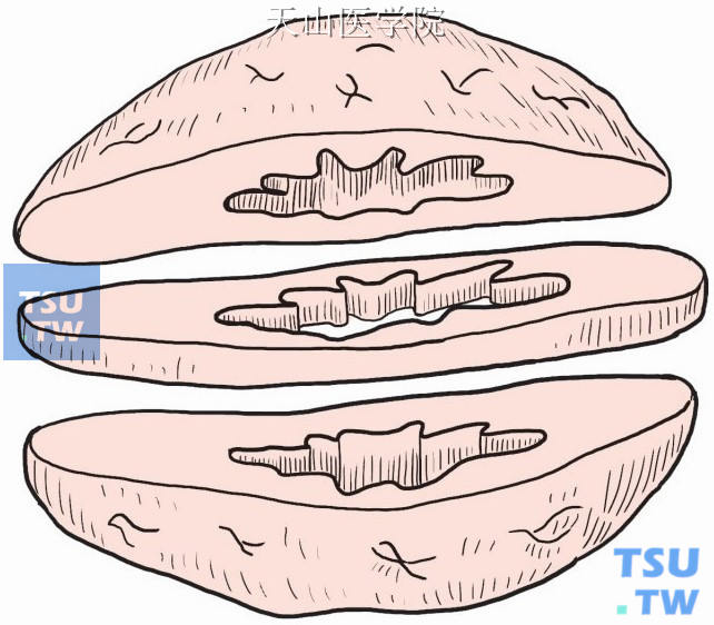 将标本中间横切两刀