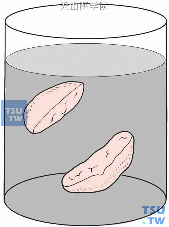 余下的半球形组织块固定1～2小时