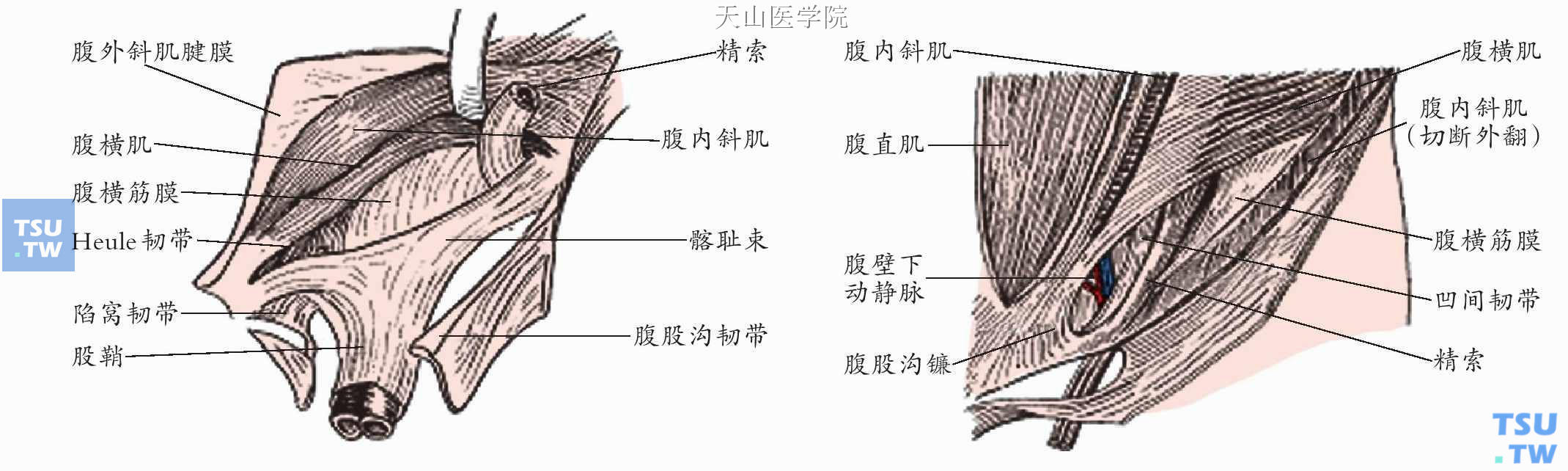 腹外疝应用解剖