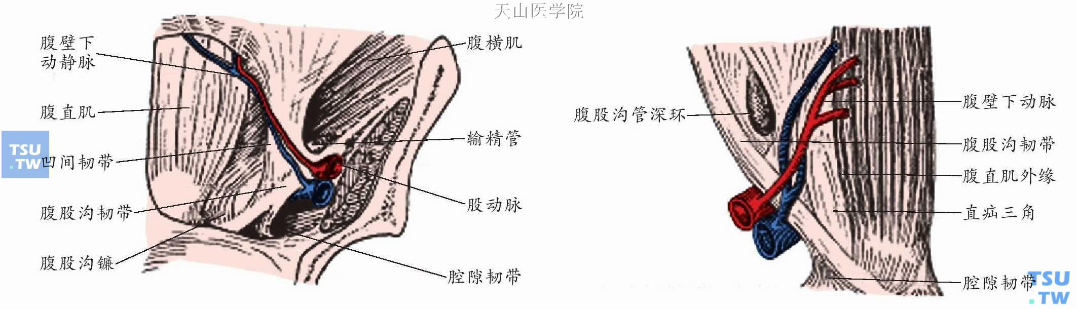 腹外疝应用解剖